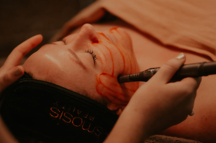 Skin Treatments